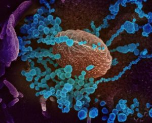 Image - Photo du virus